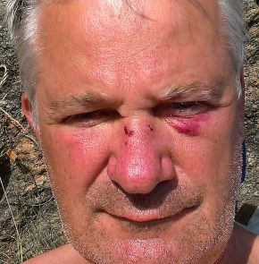 WP_20160729_17_39_13_Pro_LI